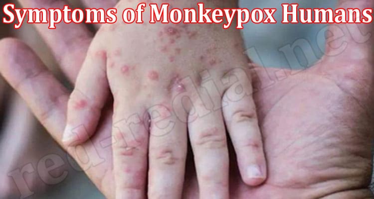 Latest News Symptoms of Monkeypox Humans