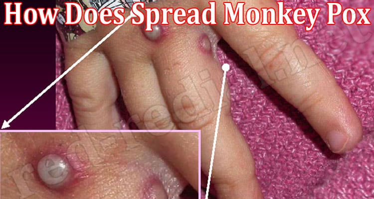 Latest News How Does Spread Monkey Pox