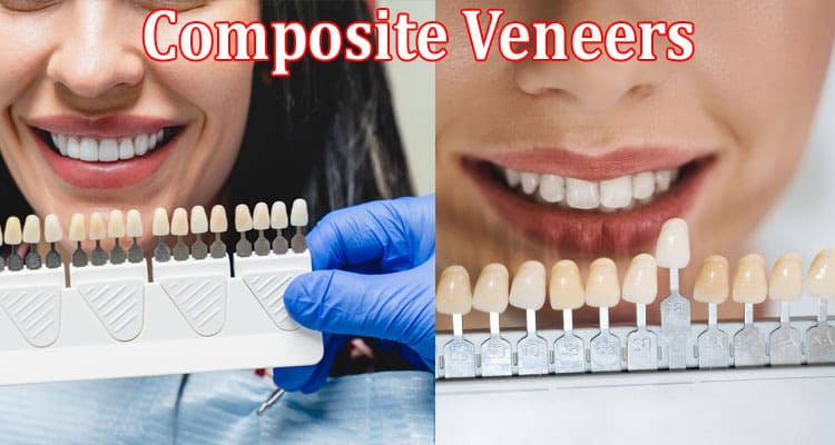 Complete Guide Details Composite Veneers